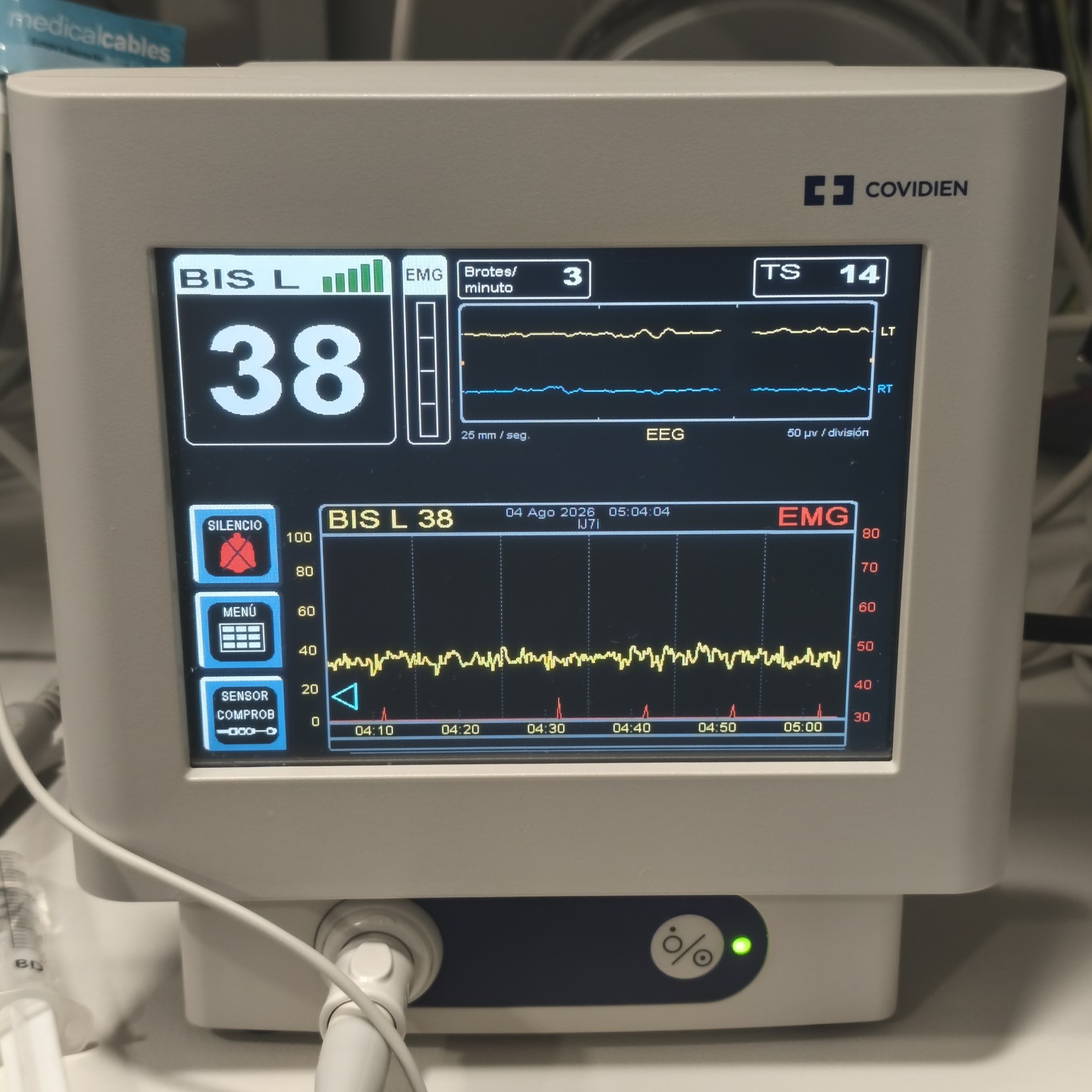Monitor BIS