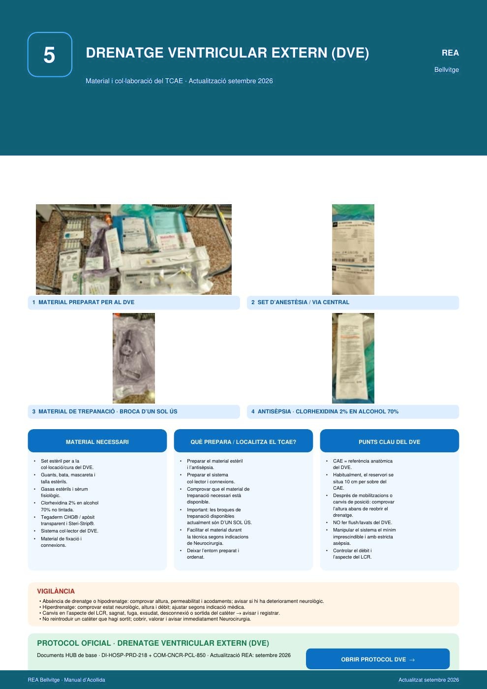 Cartel del drenatge ventricular extern